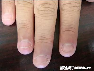 剪指甲、挖耳屎,这些日常小动作竟隐藏大危害! - 资阳生活资讯 - 资阳28生活网 zy.28life.com